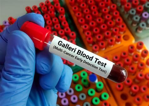 Premium Photo Galleri Blood Test For The Early Diagnosis Of Multi