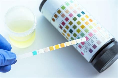 Why Urinalysis is Critical to Your Success - Peg Pavlik Wellness Coaching