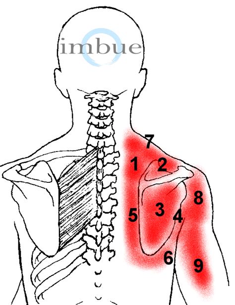 Back Shoulder Pain