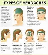 Sinus Migraine Natural Treatment Pictures