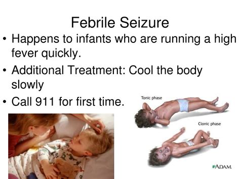 Ppt Chapter 15 Sudden Illness Powerpoint Presentation Free Download