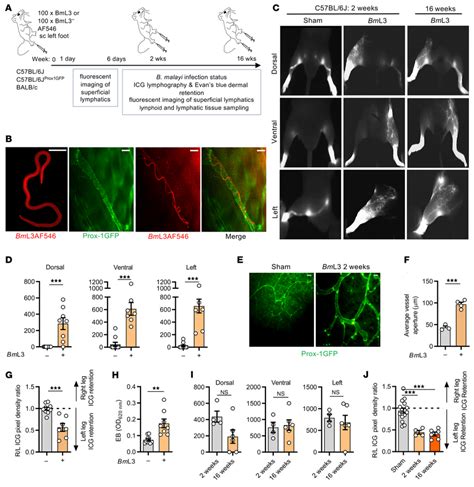 Filarial Lymphatic Infection Induces Persistent Lymphatic Pathology