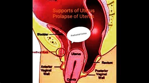 Support Of Uterus And Prolapse Youtube