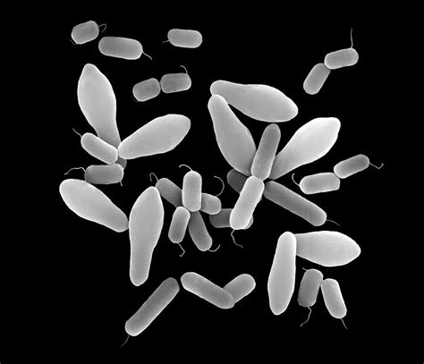 Clostridium Perfringens Photograph By Dennis Kunkel Microscopyscience