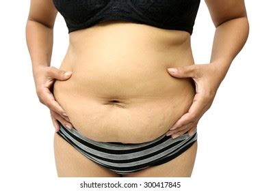 Women Fat Belly Stretch Marks Stock Photo Shutterstock