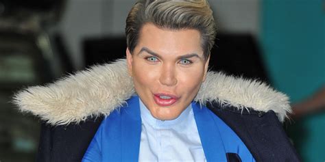 After 50 Plastic Surgeries The Human Ken Doll Can T Breathe Properly Anymore