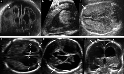 Sonographic Assessment Of Normal And Abnormal Patterns Of Fetal