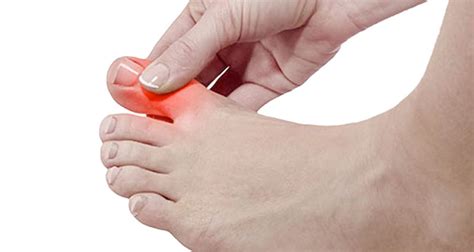Foot Pain Big Toe Joint