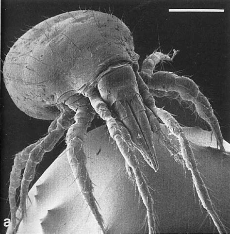 Dust Mites Everything You Might Not Want To Know