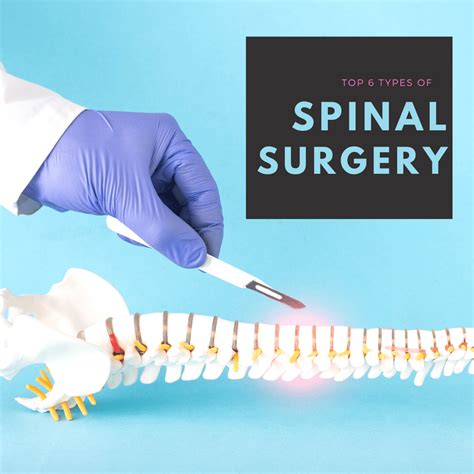 Top 6 Types Of Spinal Surgery New Jersey Comprehensive Spine Care