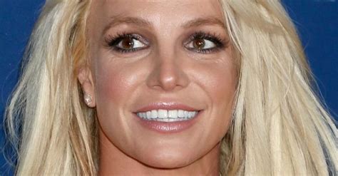 Celebrities With Dental Braces Before And After Newme