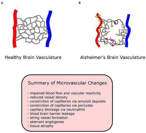 Frontiers Microvascular Alterations In Alzheimers Disease