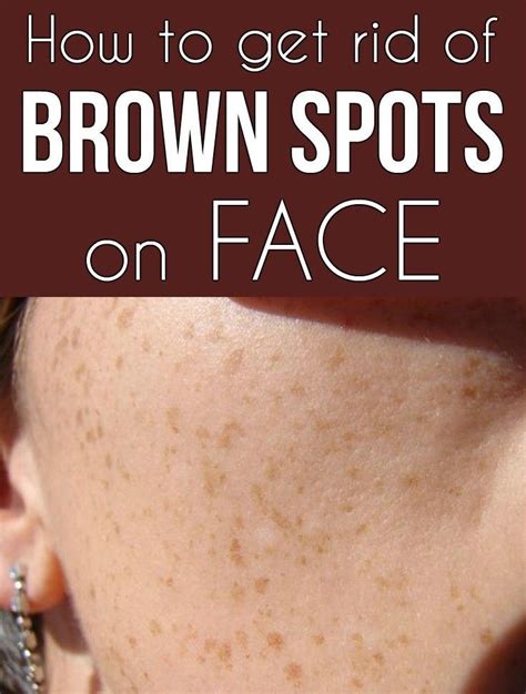 How To Get Rid Of Brown Spots On The Face Brown Spots On Face Brown