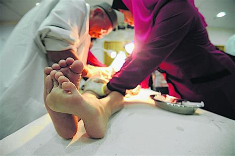 Ia boleh menjadi sakit dan mungkin menjadi bengkok apabila ereksi. Remaja Terpotong Kepala Zakar Ketika Berkhatan Peroleh ...