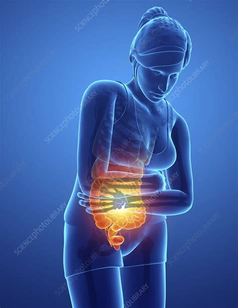 Woman With Abdominal Pain Illustration Stock Image F0226014