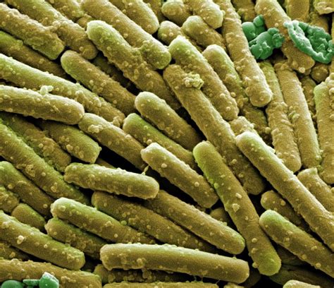 Clostridium Difficile Bacteria Photograph By Science Photo Library