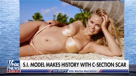 Sports Illustrated Model Photographed With C Section Scar Makes History