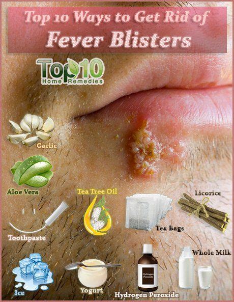 How To Get Rid Of Fever Blisters Blister Remedies Cold Sores