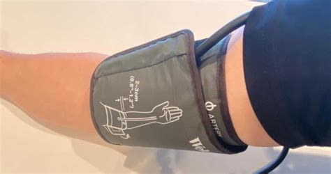 Blood Pressure Cuff Arrow Placement Which Way Does It Go