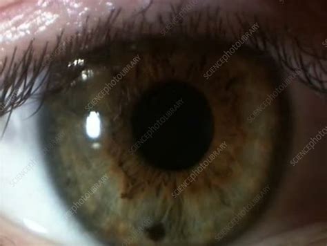 Human Eye Pupil Variation Stock Video Clip K0052404 Science