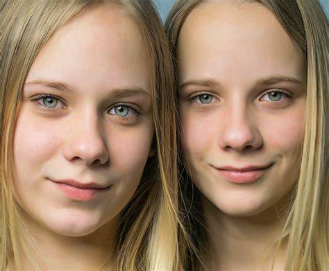 Identical Twins No Longer Genetically Identical Early In Development