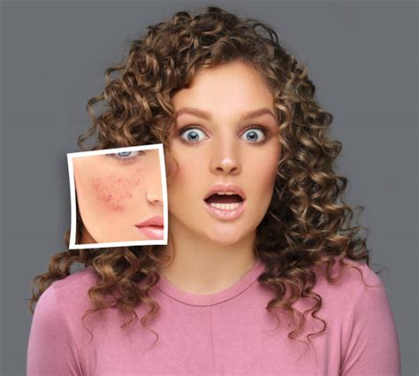 Different Skin Rashes Stock Photos Pictures And Royalty Free Images Istock