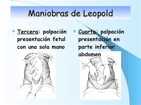 Maniobras De Leopold Enfermeria Obstetricia Anatomia Medica Images The Best Porn Website