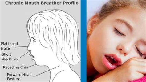 Does Mouth Breathing Send A Red Signal