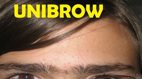 How To Get Rid Of A Unibrow Without It Growing Back Youtube