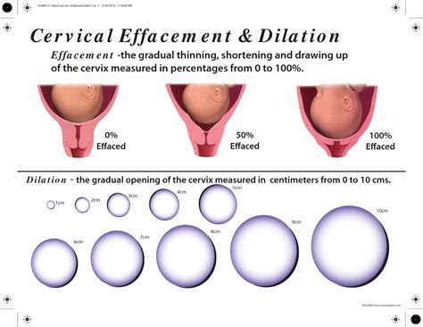 Cervical Effacement Dilation Cervical Effacement Cervix Cervix Dilation