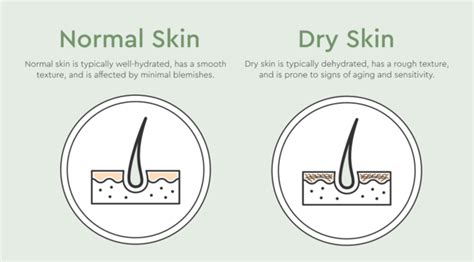 Can Dry Skin Cause Acne Possible Causes And Treatments Bioclarity
