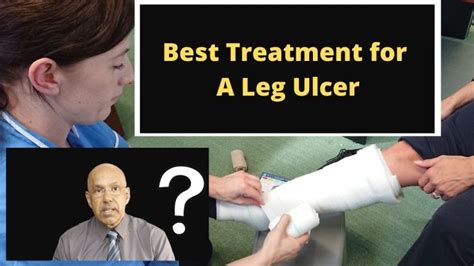 What Is The Best Way To Heal A Leg Ulcer The Veincare Centre