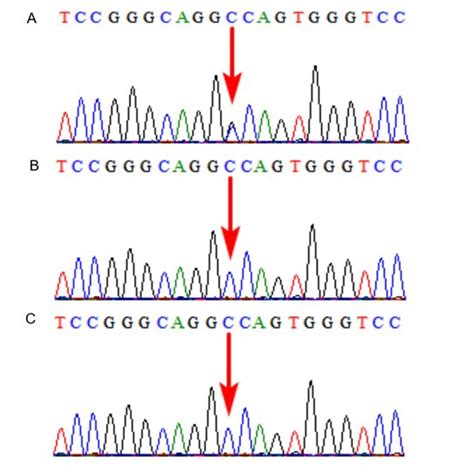 Trio Whole Exome Sequencing Results For Case 15 The Female Infant
