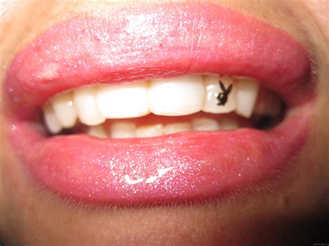 Dental Piercings Page 3