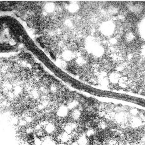 The marburg virus, which is similar to ebola but has different antigenic properties, is transmitted to there have been 12 major marburg outbreaks since 1967, when the virus was first discovered during. (PDF) Forty-Five Years of Marburg Virus Research