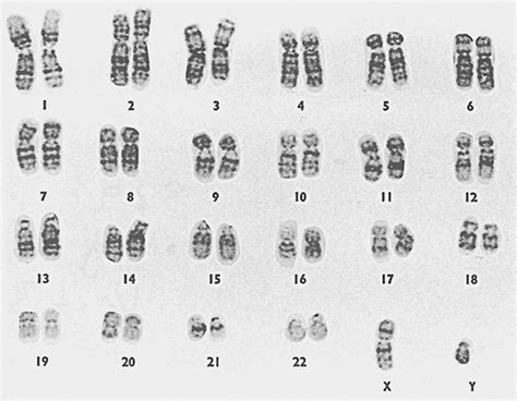 Chromosomes Under A Microscope The A Level Biologist Your Hub