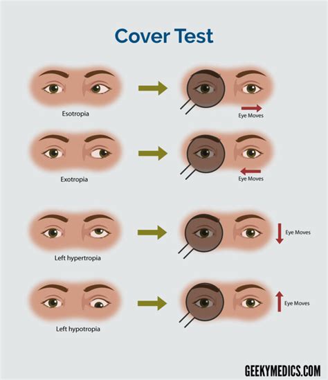 Cranial Nerve Examination Osce Guide 1b0