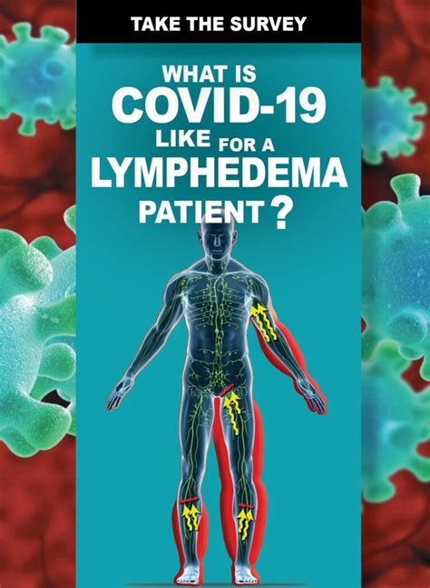 Pin By Lucilletamm On Lymphedema In 2021 Lymphedema Lymphedema
