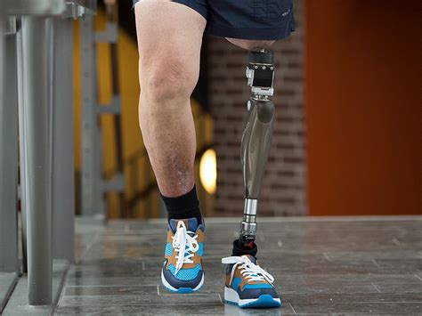 Fda Approves First Of Kind Leg Prosthesis