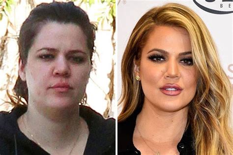 Khloe Kardashian Before And After Meme - Khloé Kardashian, Before and 