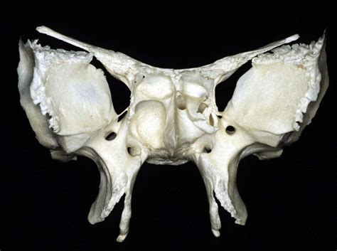 Anterior View of Sphenoid Bone | Neuroanatomy | The Neurosurgical Atlas