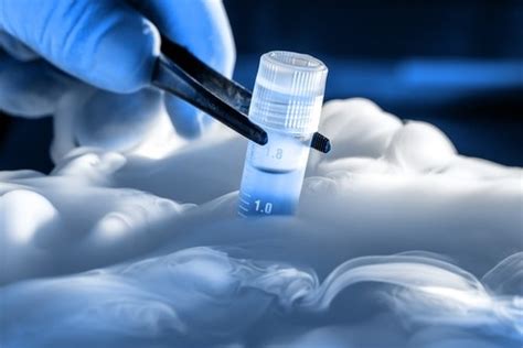 Insight Into Cryopreservation The Art Of Freezing Life Labtag Blog
