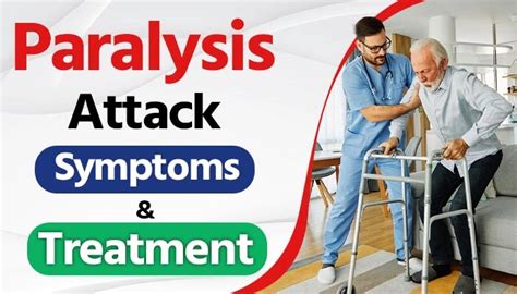 Paralysis Attack Causes Symptoms And Treatment Sai Sanjivani
