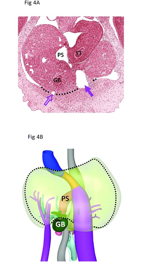 Two diagrams of liver structure removed for copyright reasons. Embryonic liver. Histological section (Fig 4A) and 3D model (Fig 4B) of... | Download Scientific ...
