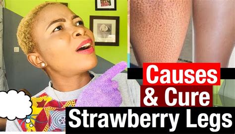 Causes And How To Get Rid Of Strawberry Legs Strawberry Legs