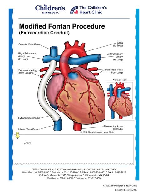 Modified Fontan Procedure Extracardiac Conduit Docslib