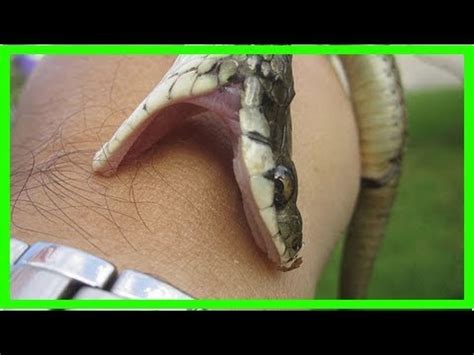 Que Faire En Cas De Morsure De Serpent Les Tapes Suivre Youtube