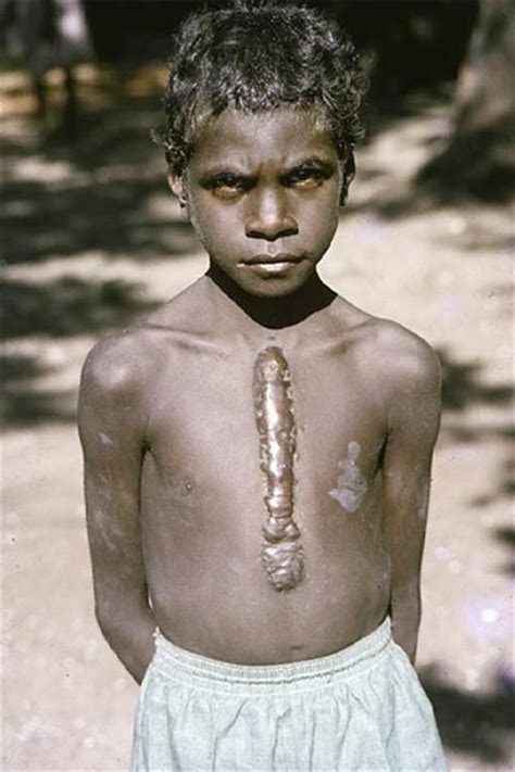 traditional body modification  indigenous australians