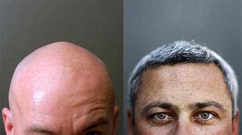 scientists discover a gene they believe is responsible for grey hair
