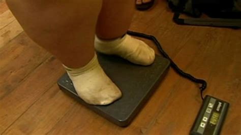 Doctors Worries About Increasing Rates Of Super Obesity Bbc News